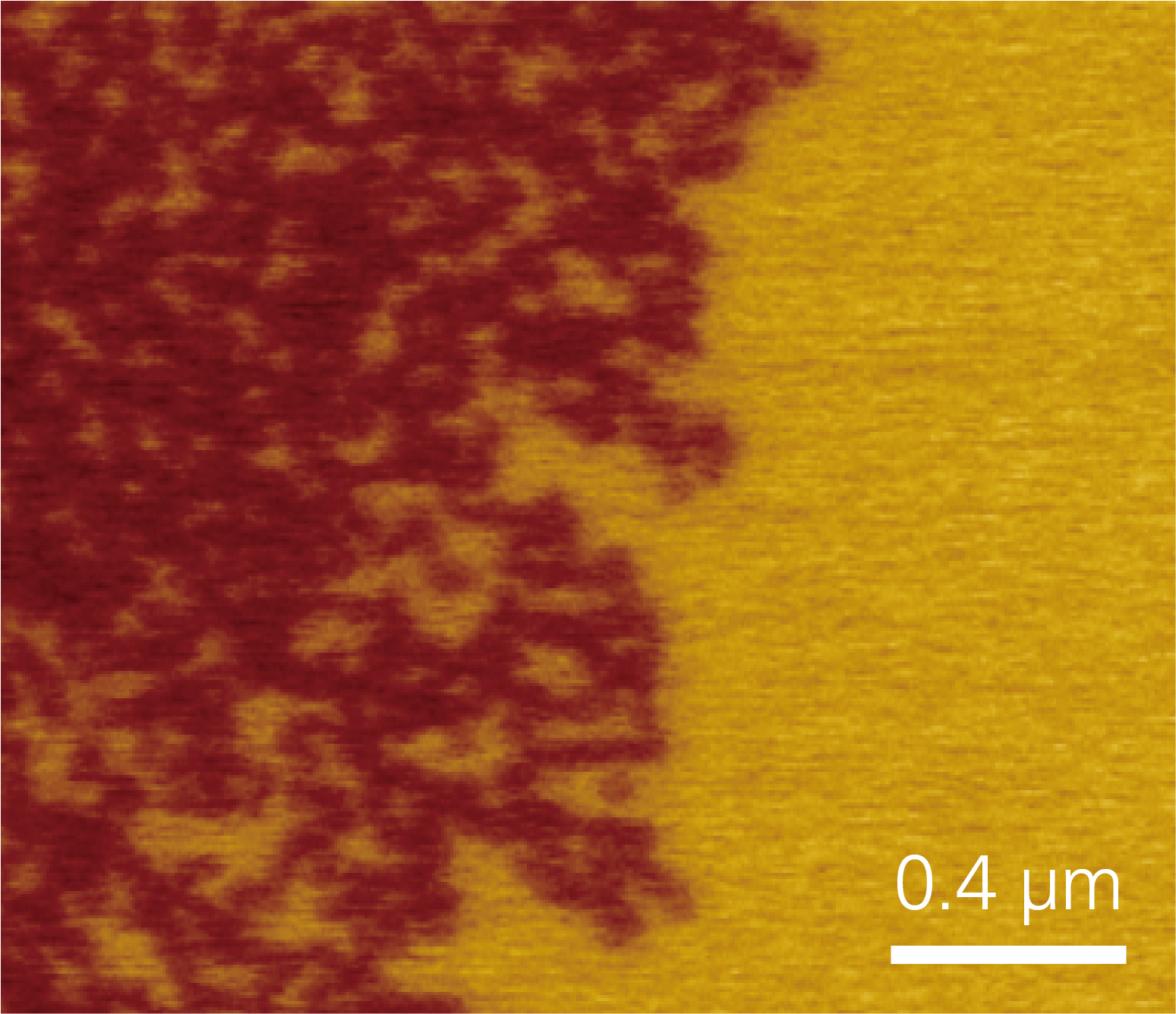 F14H20 microscopy image
